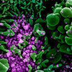 <p>This color-enhanced image, taken by scanning electron microscopy, shows huge quantities of SARS-CoV-2 particles (purple) that have burst out of kidney cells (green), which the virus hijacked for replication. The bulging, spherical cells in the upper-right and bottom-left corners are distorted and about to burst from the viral particles inside, and are beginning to self-destruct. (Credit: NIAID Integrated Research Facility)</p>
