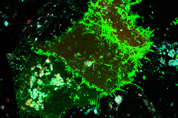 fluorescent microscopic image of two cells being infected with virus