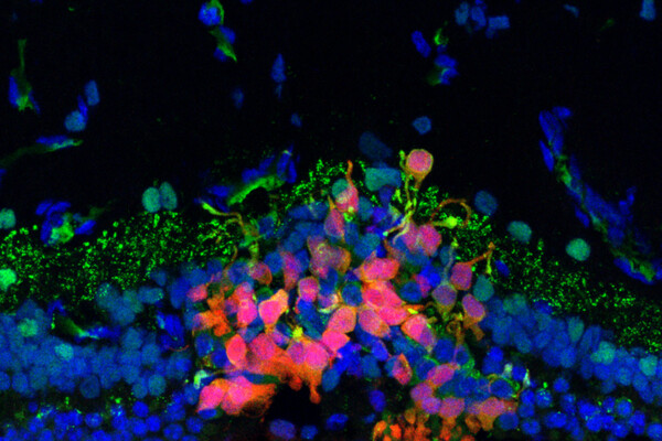 Fluorescent microscopy against a black background shows a layer of green flecks over a mix of blue and red labeled cells