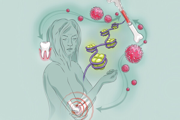 graphic of a person with both gum inflammation and arthritis in an elbow, showing the cells involved in the relationship between the two conditions