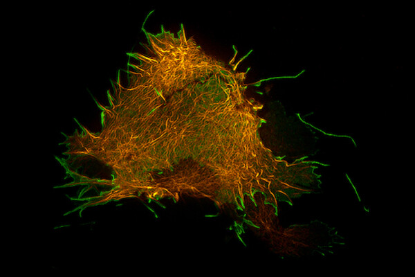 A fluorescent microscopic image of a cell labeled in orange with virus particles emerging from it labeled green.