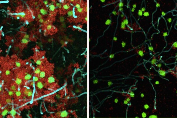 side-by-side microscopic images of microbes with fluorescent labels, with right side looking more empty