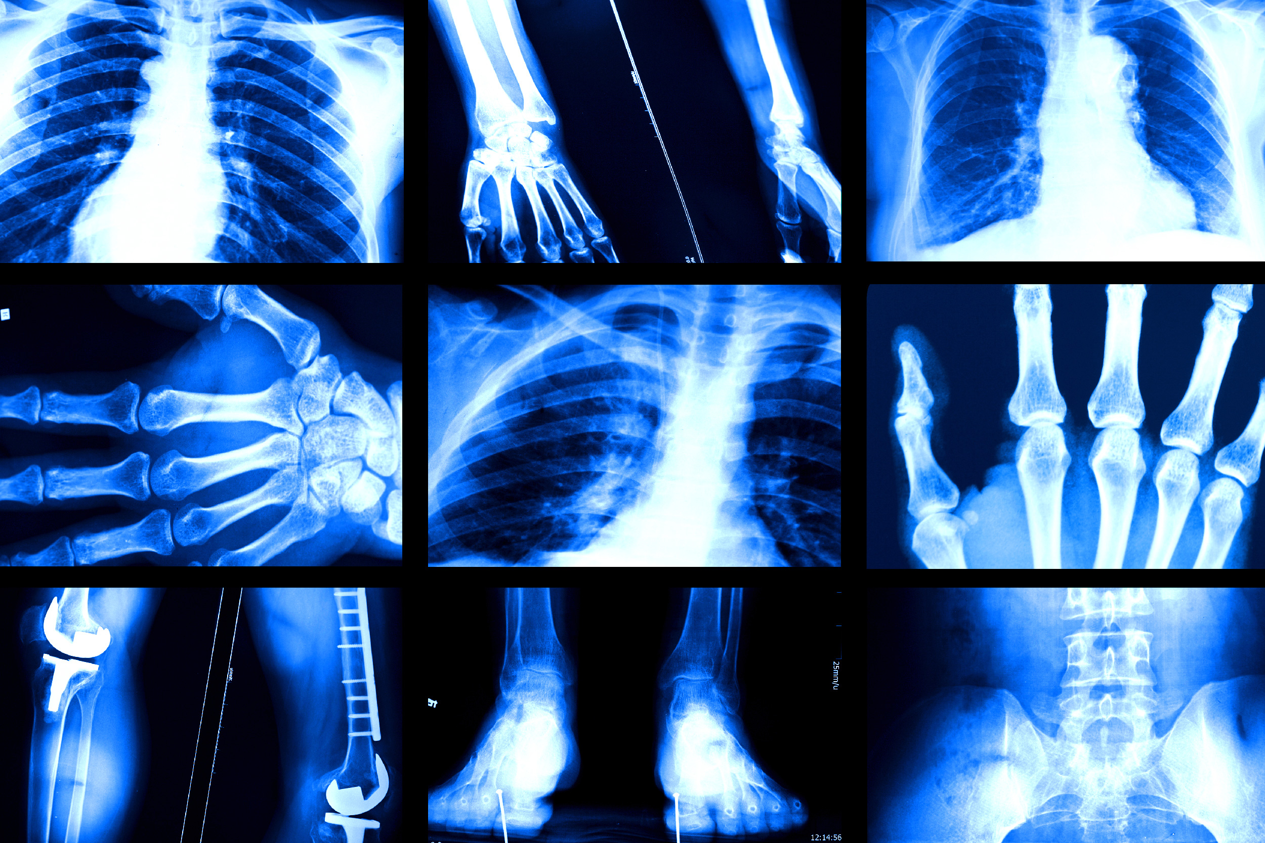 Image: MIT News; iStock 