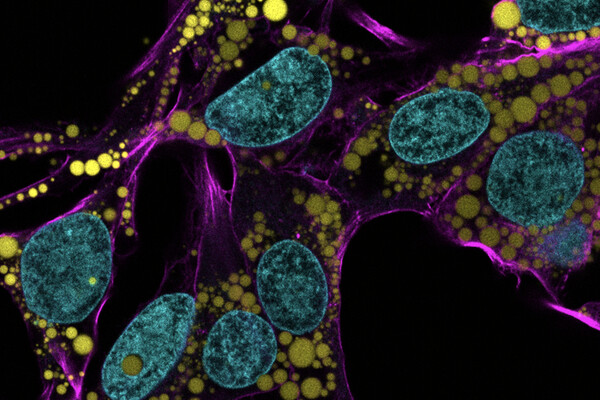 Microscopic view of fat molecules.
