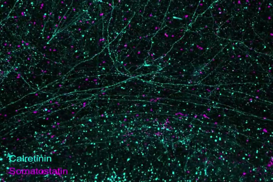 Image courtesy of Kwanghun Chung/Juhyuk Park et. al. 